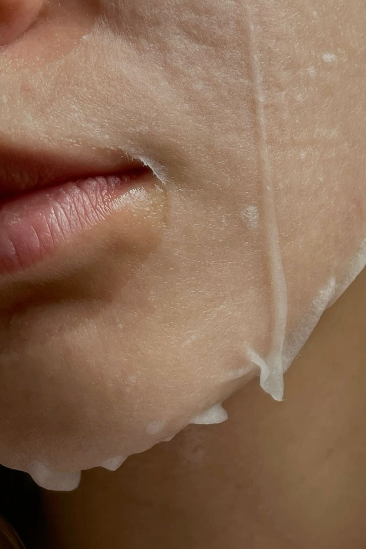 Fine Lines & Wrinkles